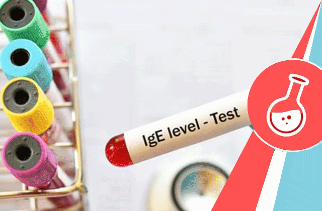 IgE Allergy Blood Tests Market Key Players, Dynamics & Latest Trades Report to 2030