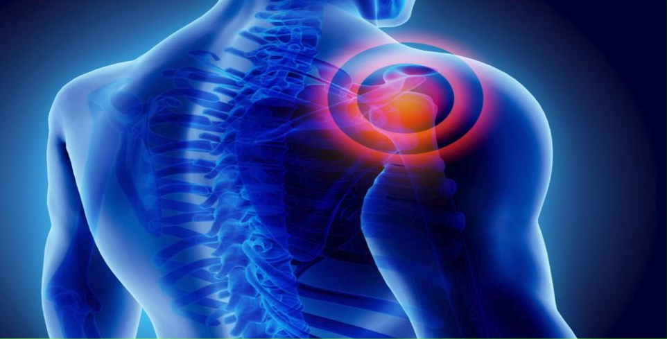 6 Effective Treatments for a Rotator Cuff Injury