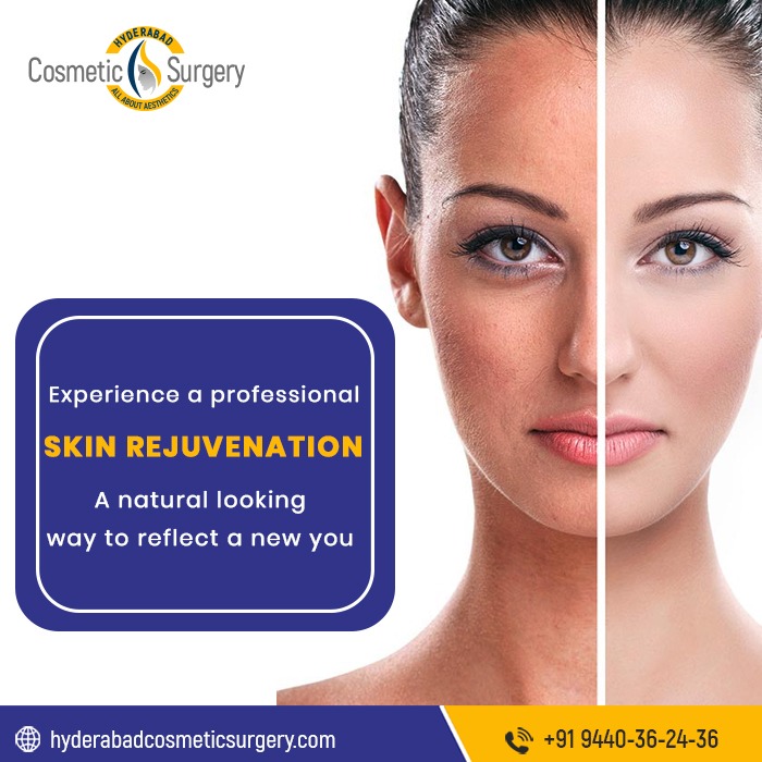 skin tag removal in Hyderabad