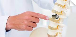 Kyphoplasty Market 2022 Growth, Share & Forecast Report to 2028