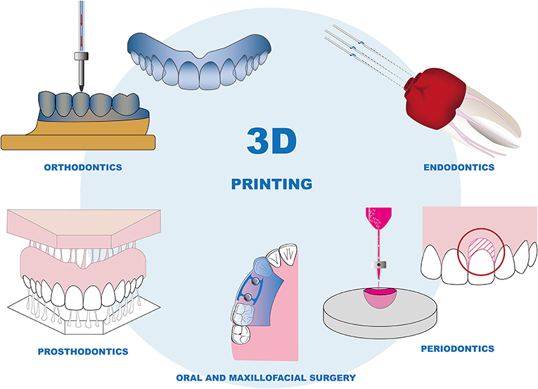 Dental 3D Printing Market | Industry Analysis | Market Size | 2035