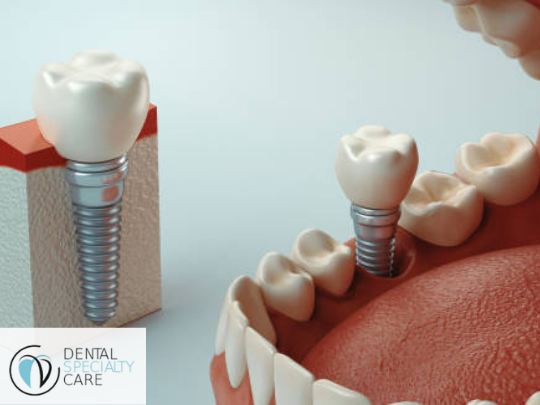 WISDOM TOOTH EXTRACTION