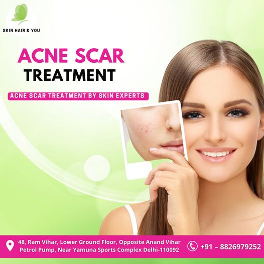 ERASE THE SKIN WRINKLES USING LATEST TECHNOLOGY