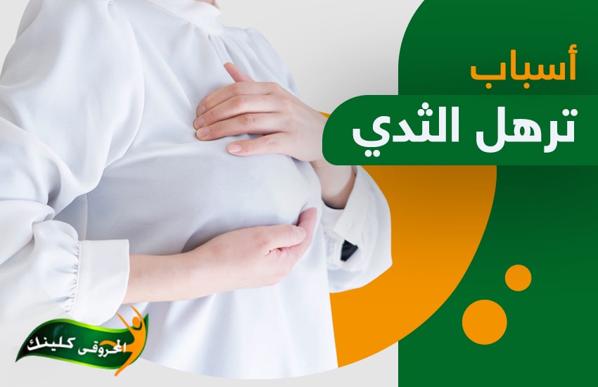 اسباب ترهل الثدي