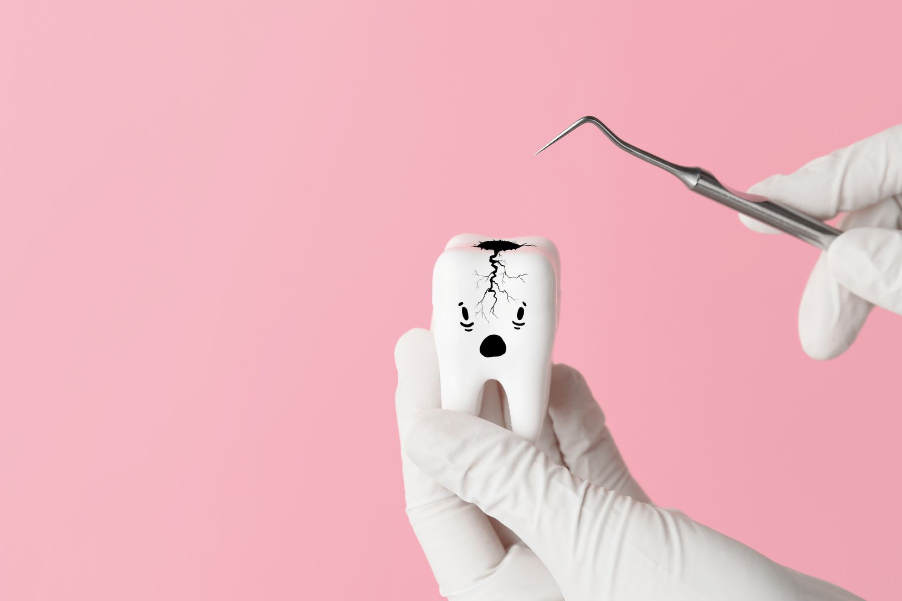 Root Canal Treatment for Cracked Teeth: How it Works