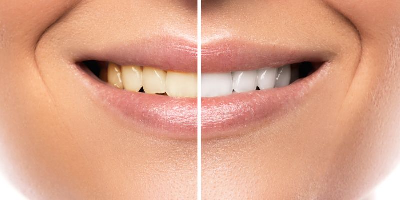 Ways to Improve Your Smile