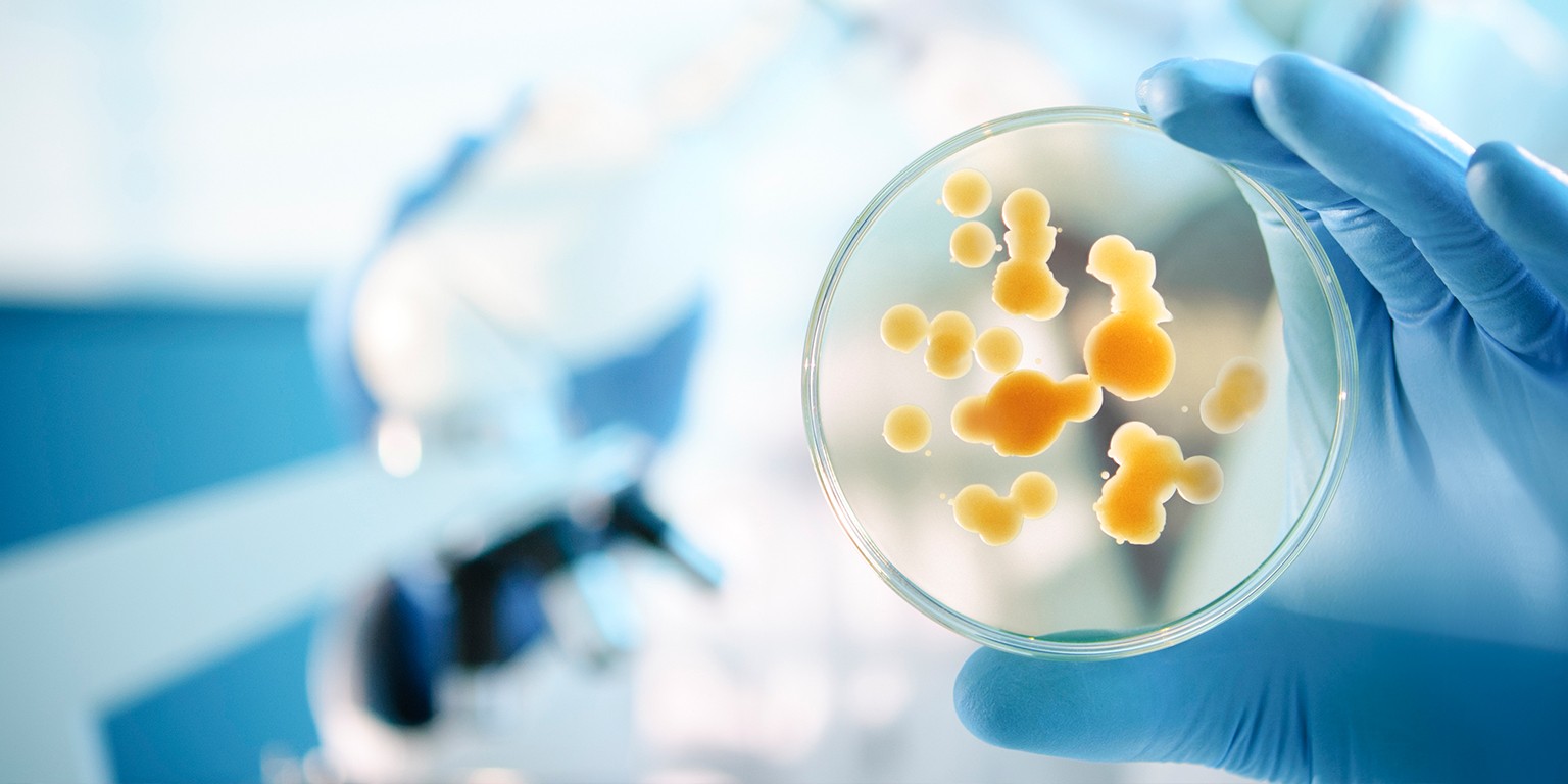 Global Microbial Control Market Trends, and Forecast 2022-2025
