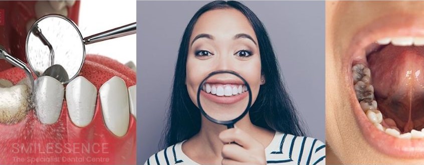Reasons to Visit a Dental Implant Clinic - Smilessence