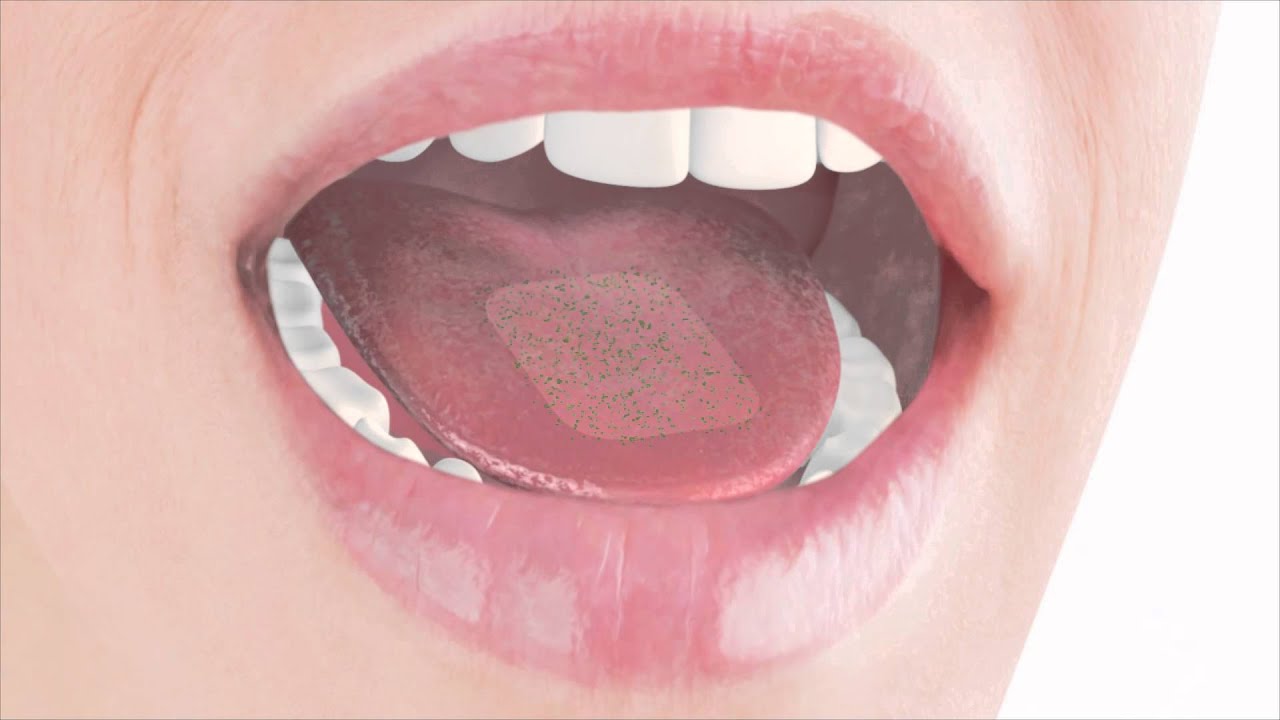  Oral Thin Films: Revolutionizing the Way Medications are Taken