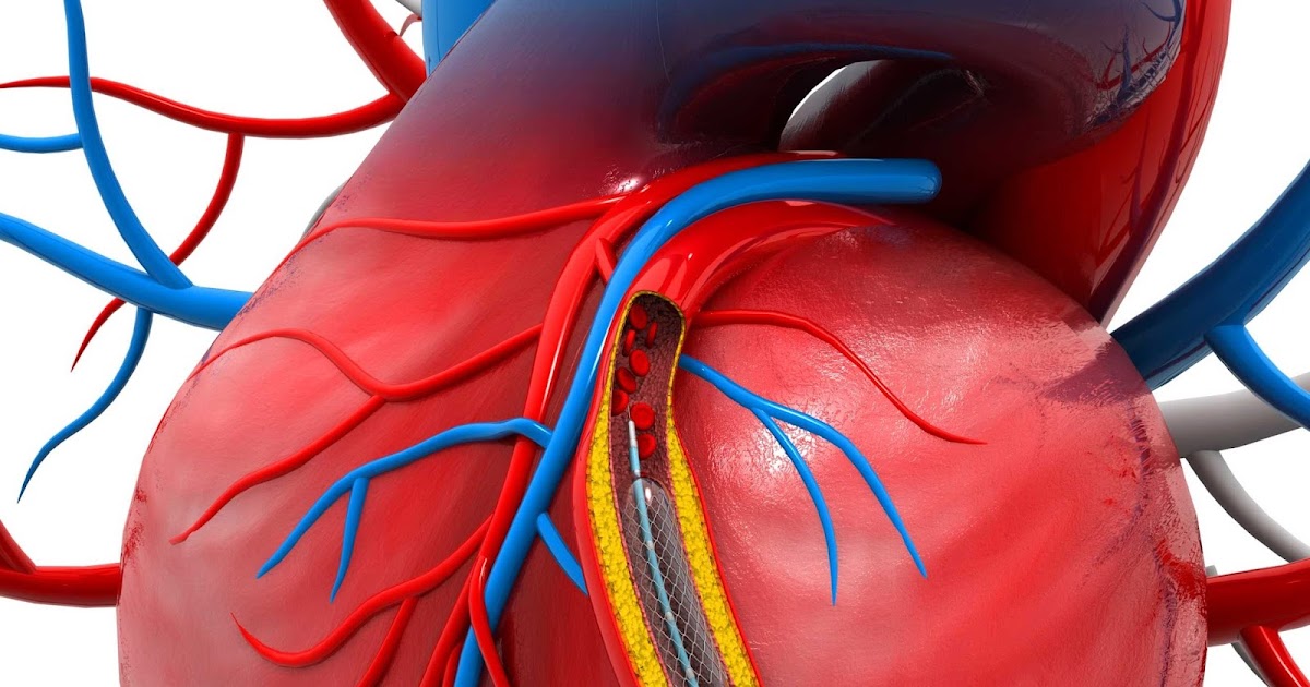 Revolutionizing Heart Health: The Role of Cardiovascular Stents