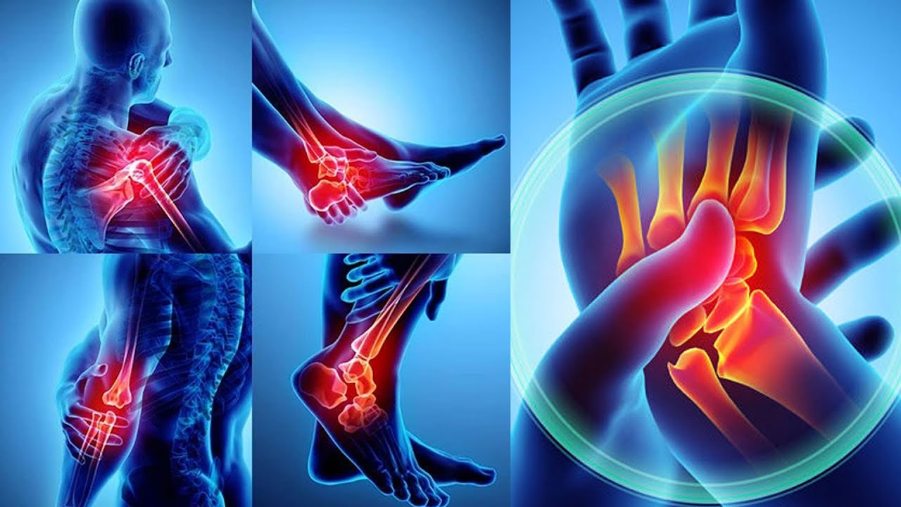  Chronic Pain Is A Persistent And Frequently Severe Type Of Pain That Can Last For Weeks, Months, Or Even Years