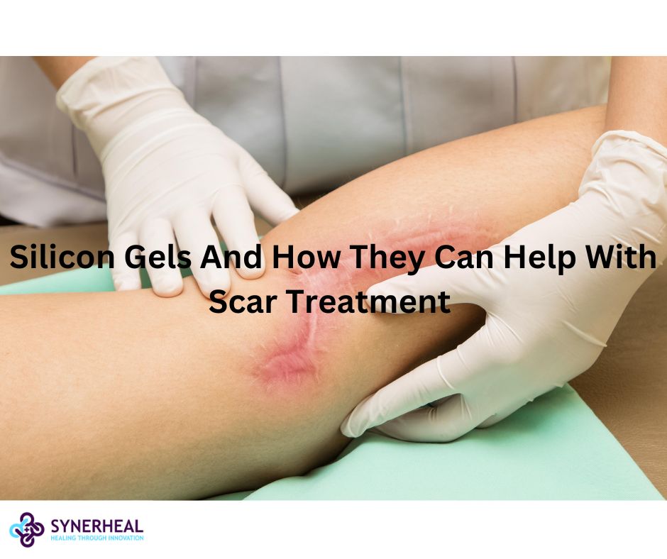 Silicon Gels And How They Can Help With Scar Treatment 