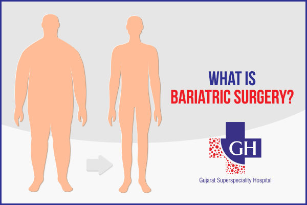 What is Bariatric Surgery? What are the Different Types of Bariatric Surgery