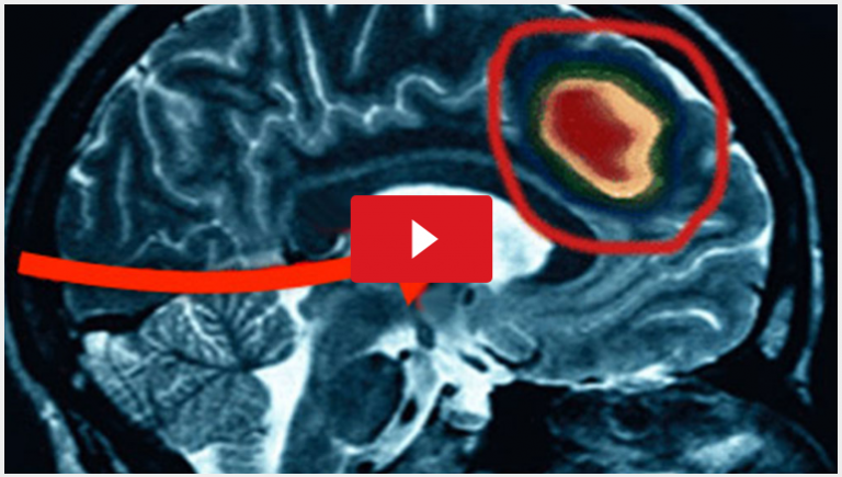 Know the Causes, Stop the Noises - How to Stop Ear Ringing