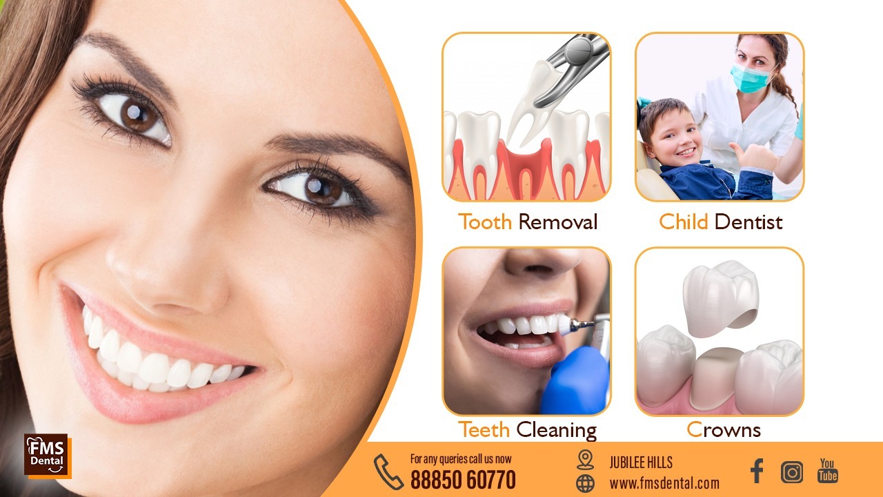Best Dental Clinic in Vivekananda Nagar
