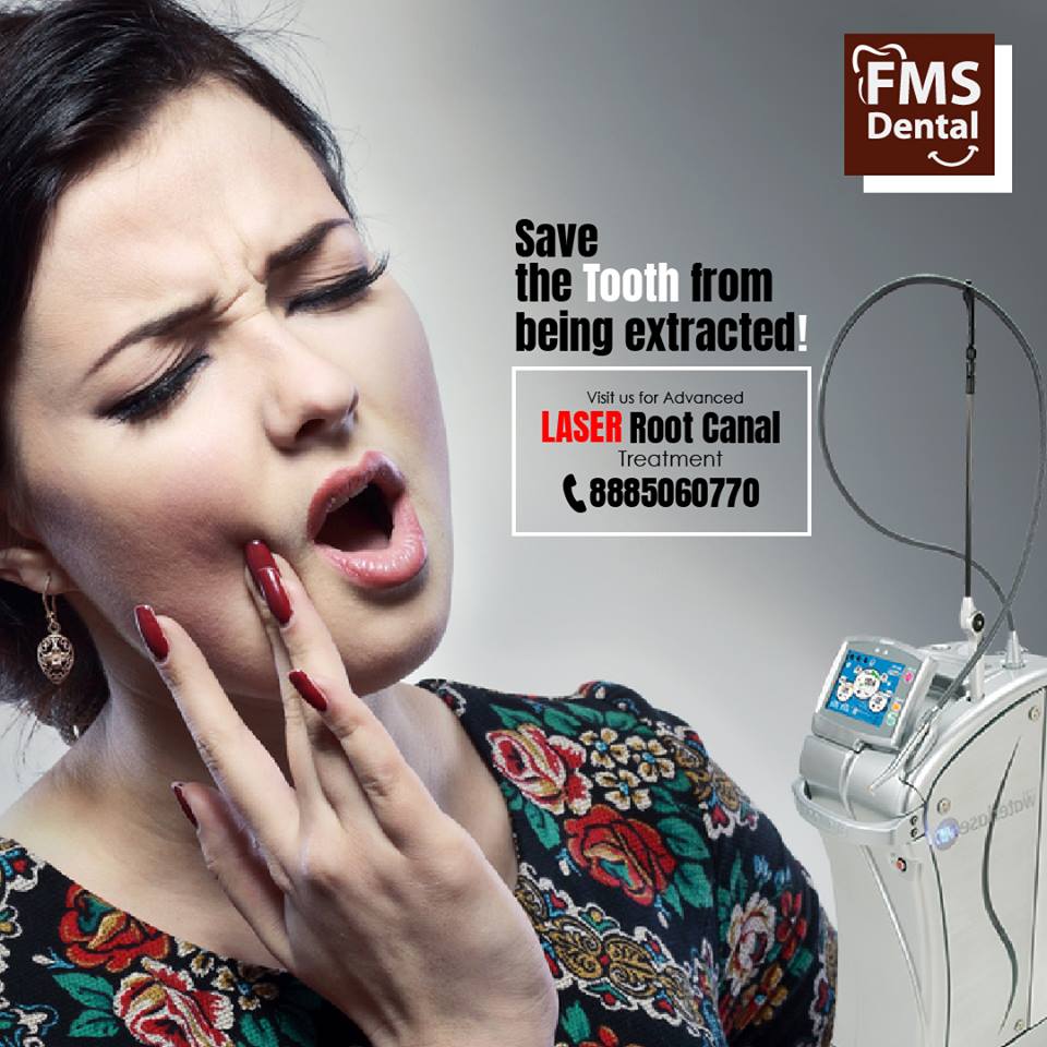 Best Root Canal Treatment and cost in Hyderabad India