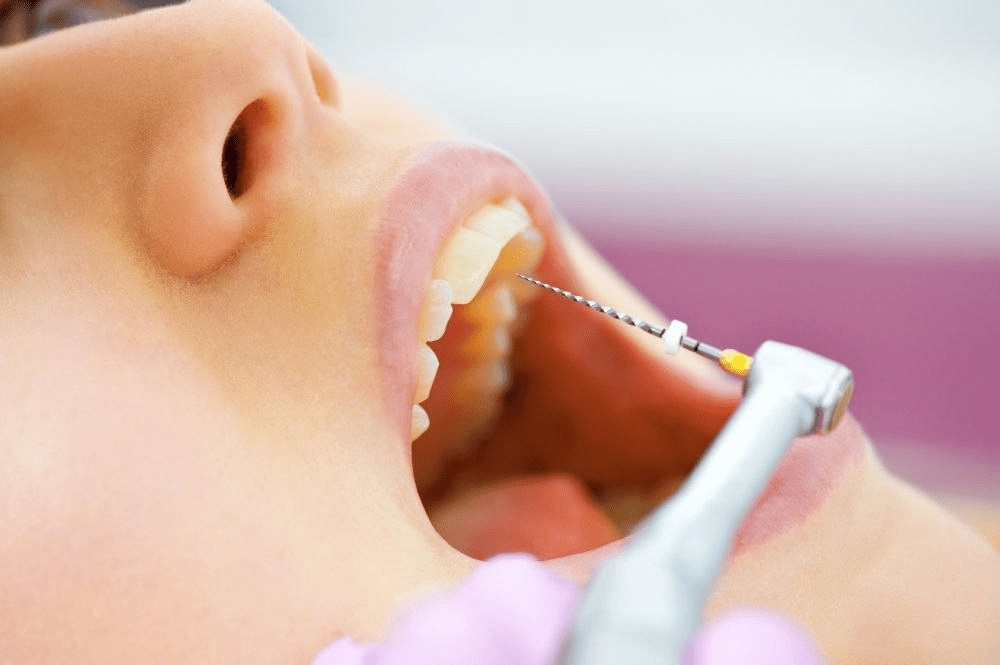 Best Root Canal Specialist Near Me Tips You Will Read This Year