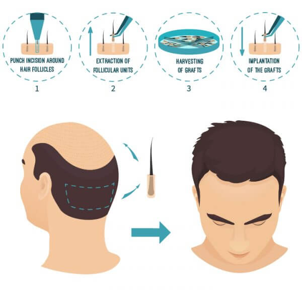 Non-surgical and Non-invasive Treatment Methods for Better Core