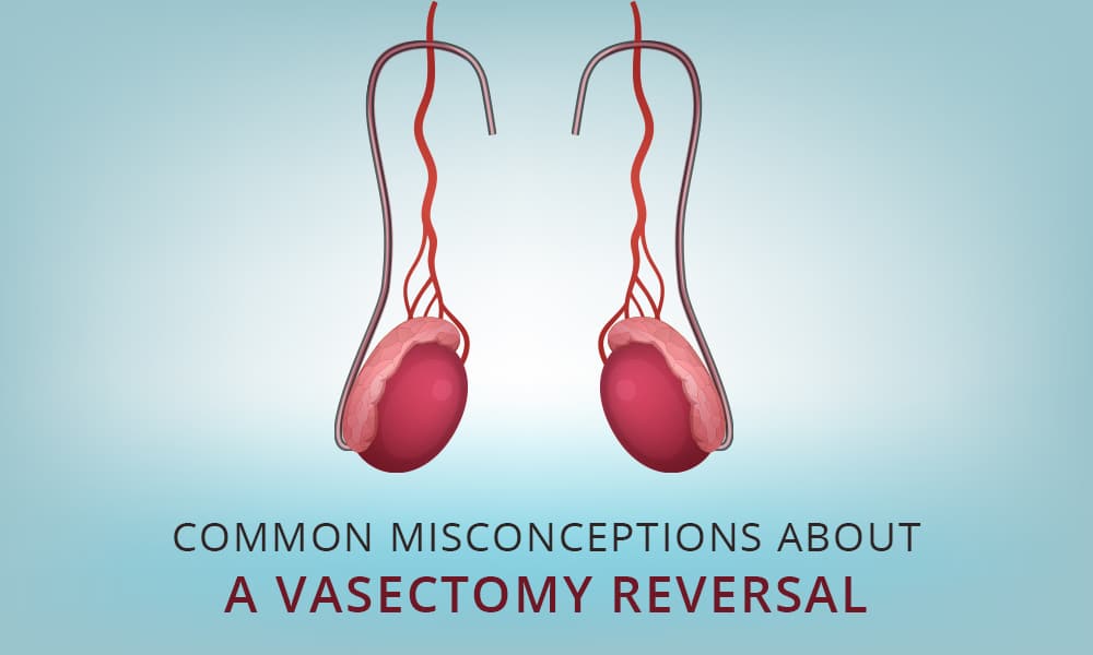 The Reality of Vasectomy Reversals: Success Rates Explained