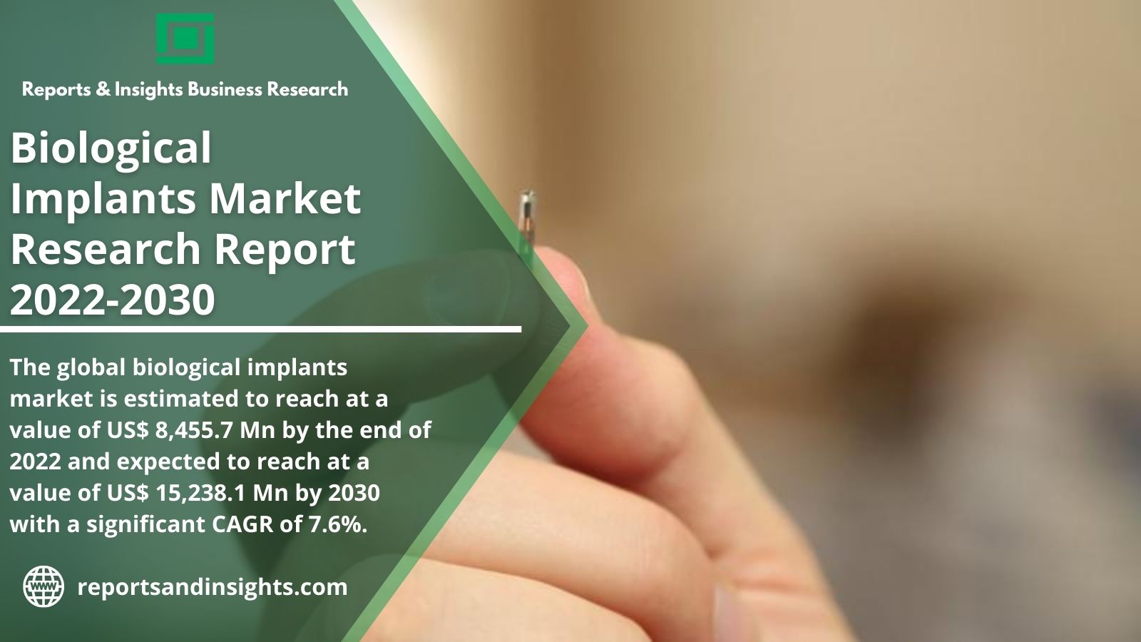 Regional Report on Biological Implants Market Size, Share & Forecast Analysis | Covid-19 Impact Analysis 2030