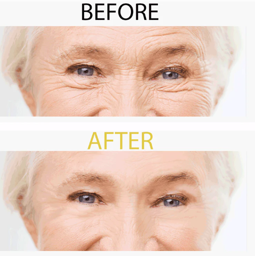 How does NMN affect the aging process in humans?