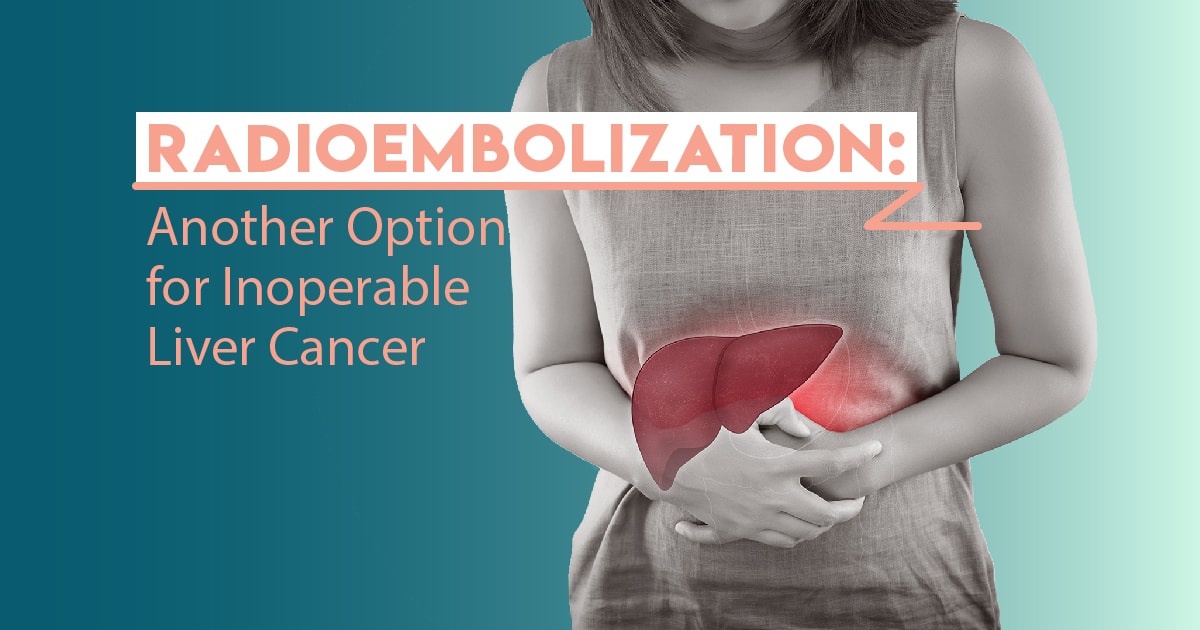 Radioembolization Therapy Market 2022 Major Key Players and Industry Analysis Till 2028