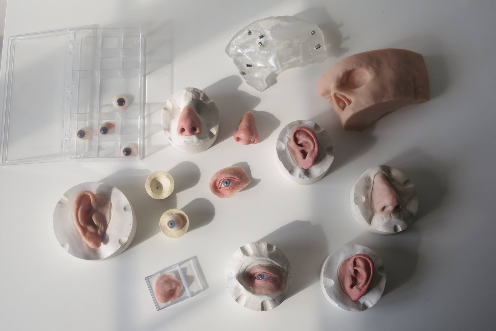 Beautify distort the ear lobes congenital - ear small