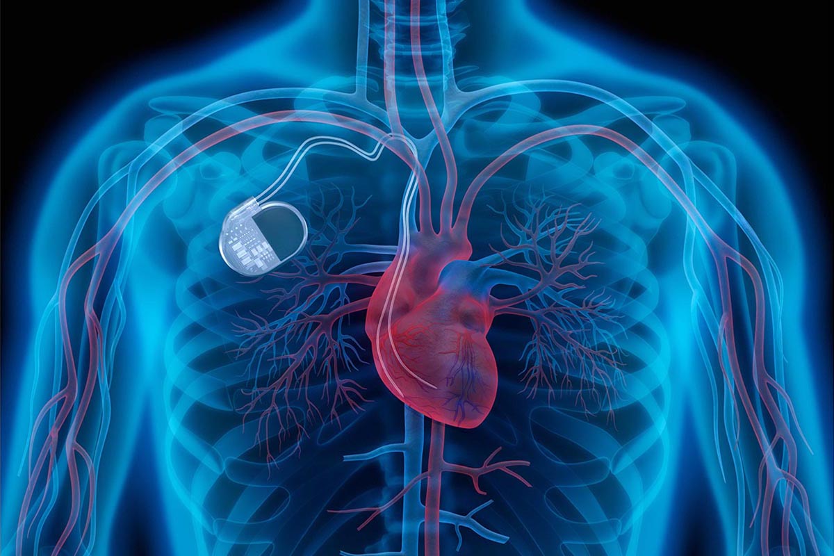 When Should You Visit a Heart Clinic for Exams?