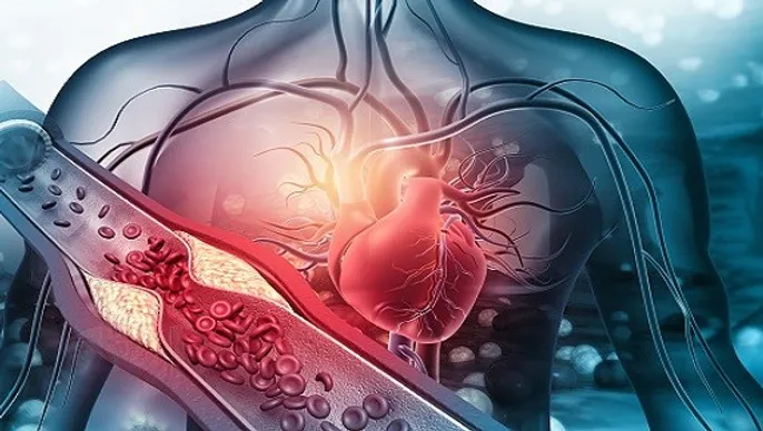  UNDERSTANDING THE SIGNS OF HEART ATTACK