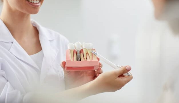 The Best Ways To Find Affordable Dental Implants In Penrith