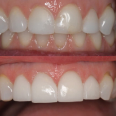 Affordable Dentist in Langley