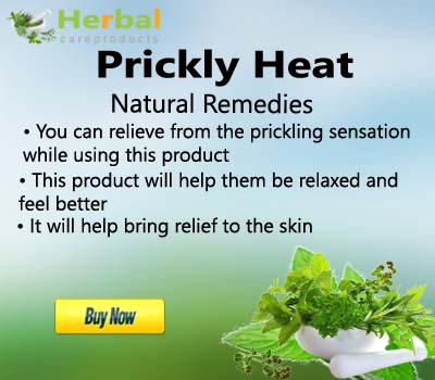 How to Cure Prickly Heat Rash During this Summer