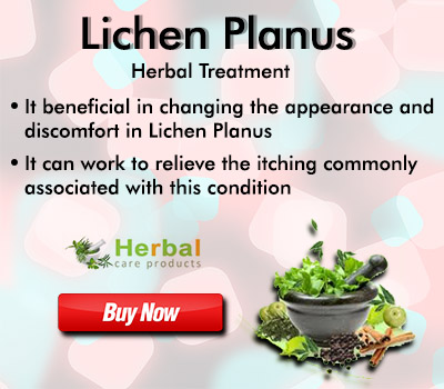 Herbal Treatment for Lichen Planus - Herbal Care Products