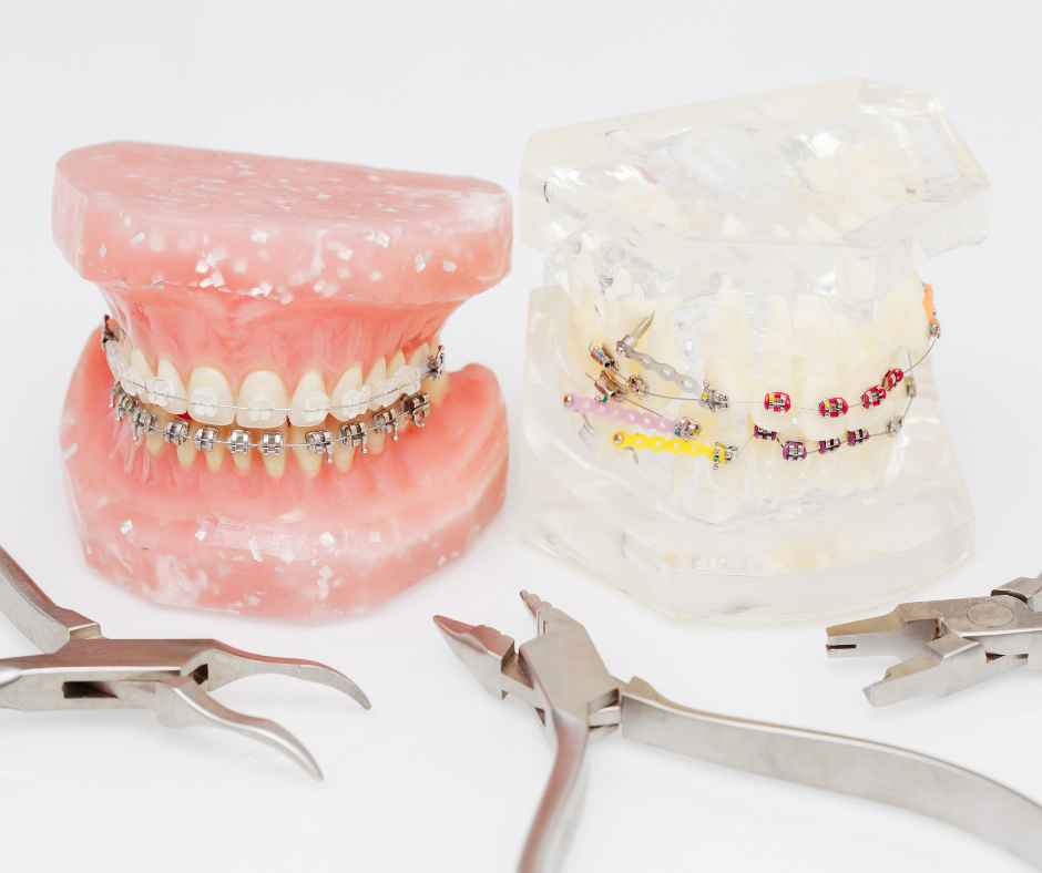 Embracing Change: Is 25 Too Old for Braces?