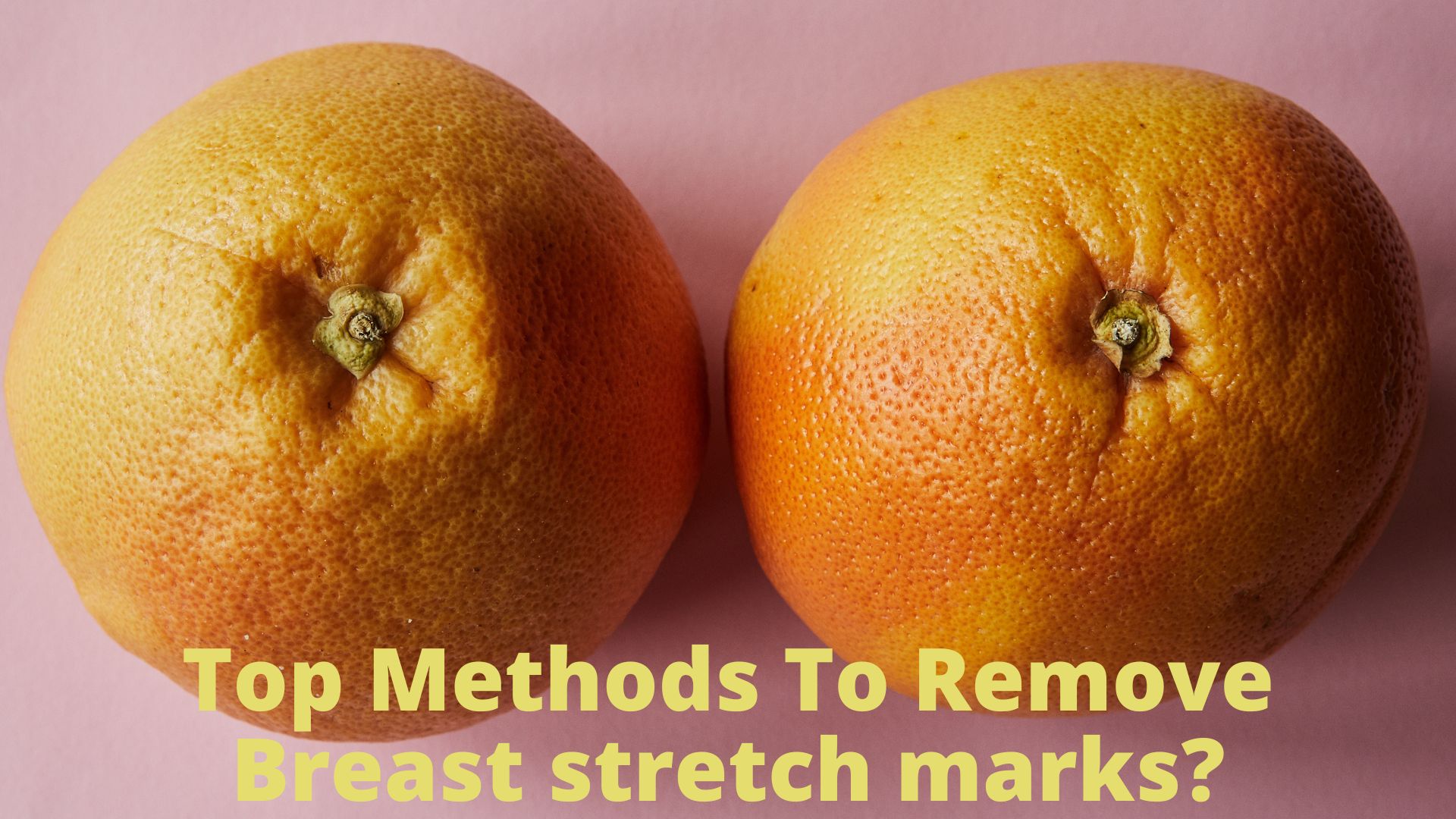 5 Helpful Tips for Reducing Stretch Marks Quickly