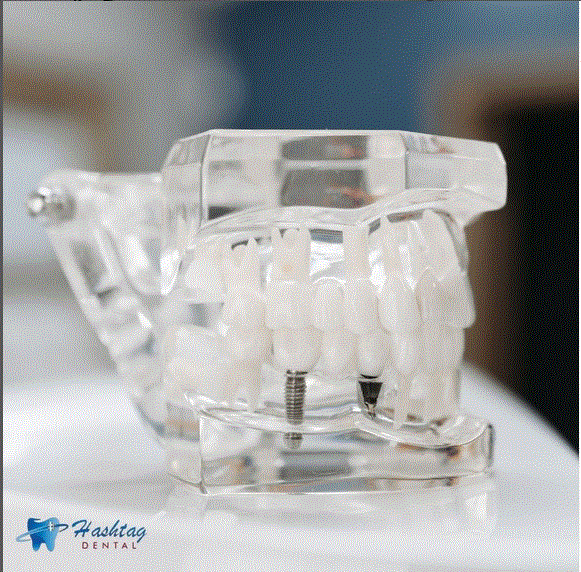 Hashtag Dental in Viman Nagar