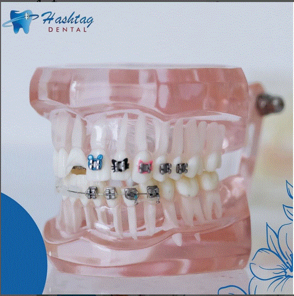 Hashtag Dental Clinic Viman Nagar