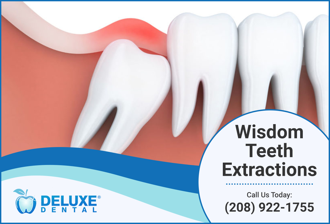 Wisdom Teeth Extractions Kuna | Deluxe Dental