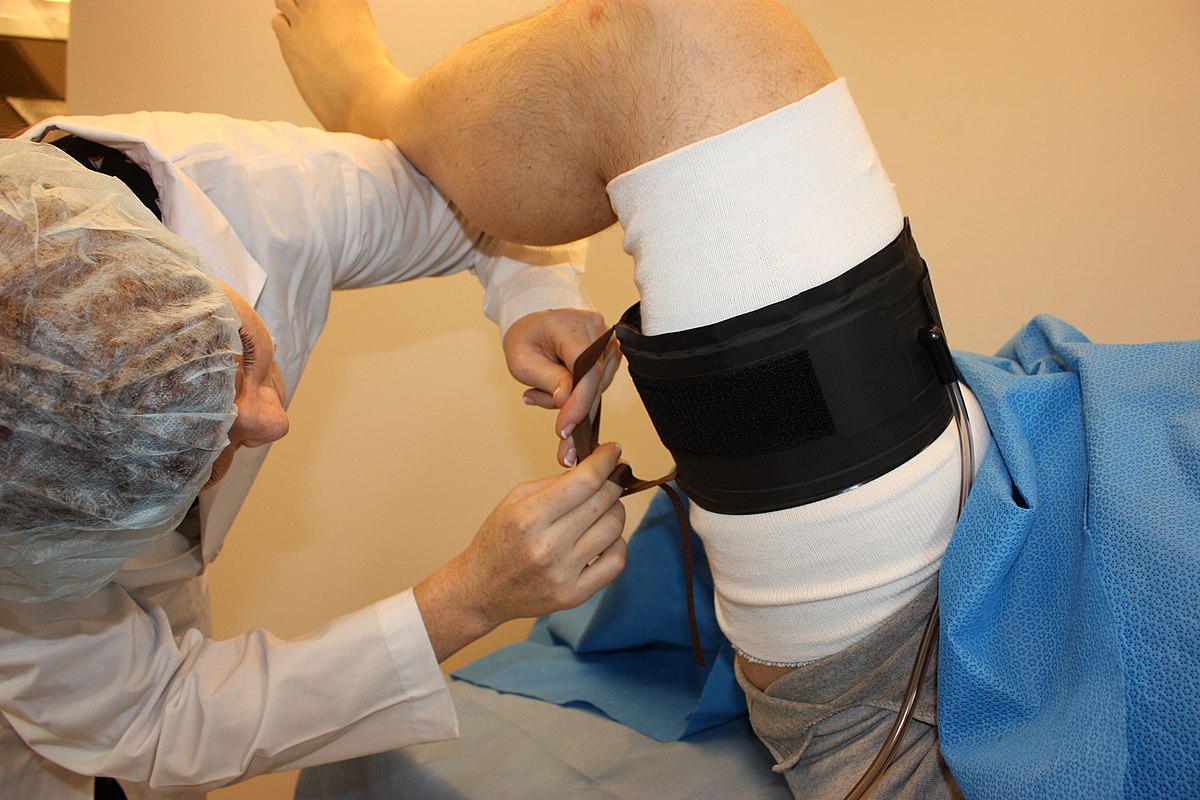 Surgical Tourniquets Market Growing at Rapid Pace: Key Drivers and Future Trends