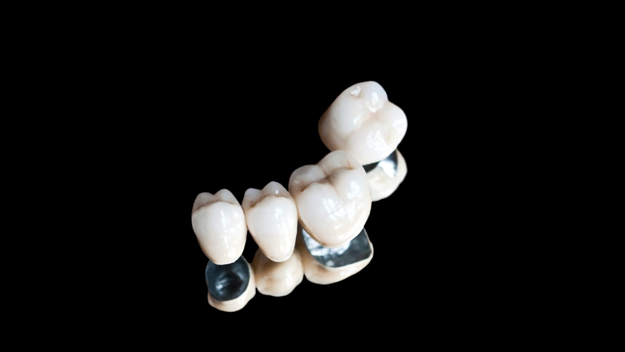 Do You Need Dental Crown After Root Canal Therapy