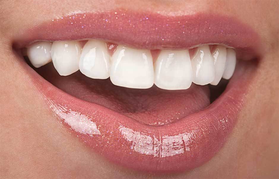 Follow These Tips to Find The Best Cosmetic Dentist