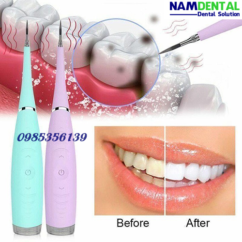 Máy lấy cao răng tại nhà