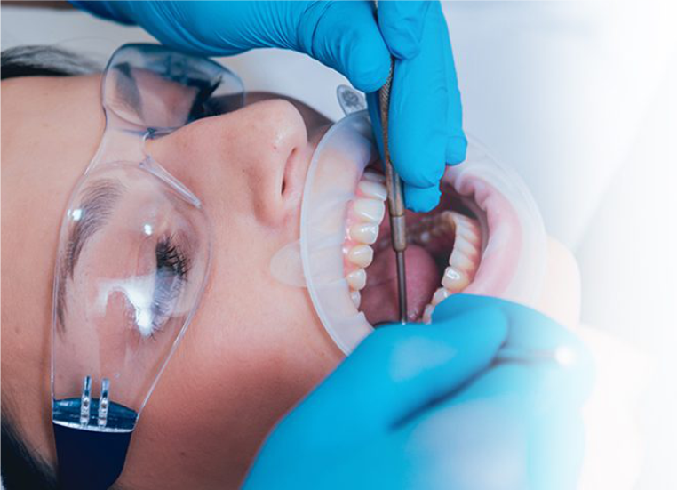 What Are The Benefits of Root Canal Treatment