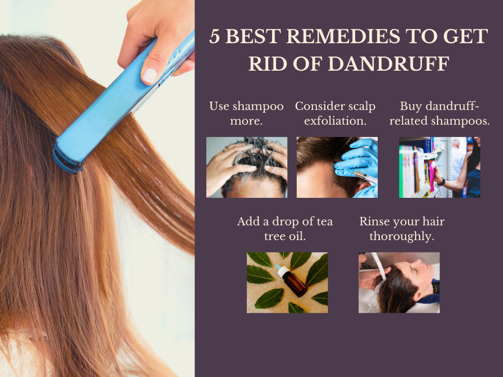 5 Best Remedies to Get Rid of Dandruff 