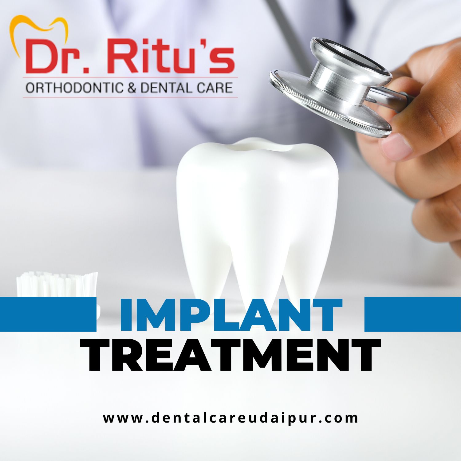 Get Beautiful Teeth by Dental Implant Treatment  in Udaipur