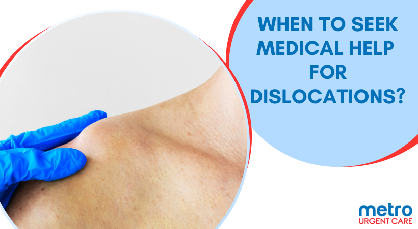 When to Seek Medical Help for Dislocations?