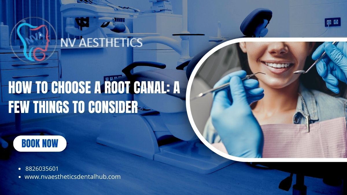 How To Choose A Root Canal Treatment: A Few Things To Consider
