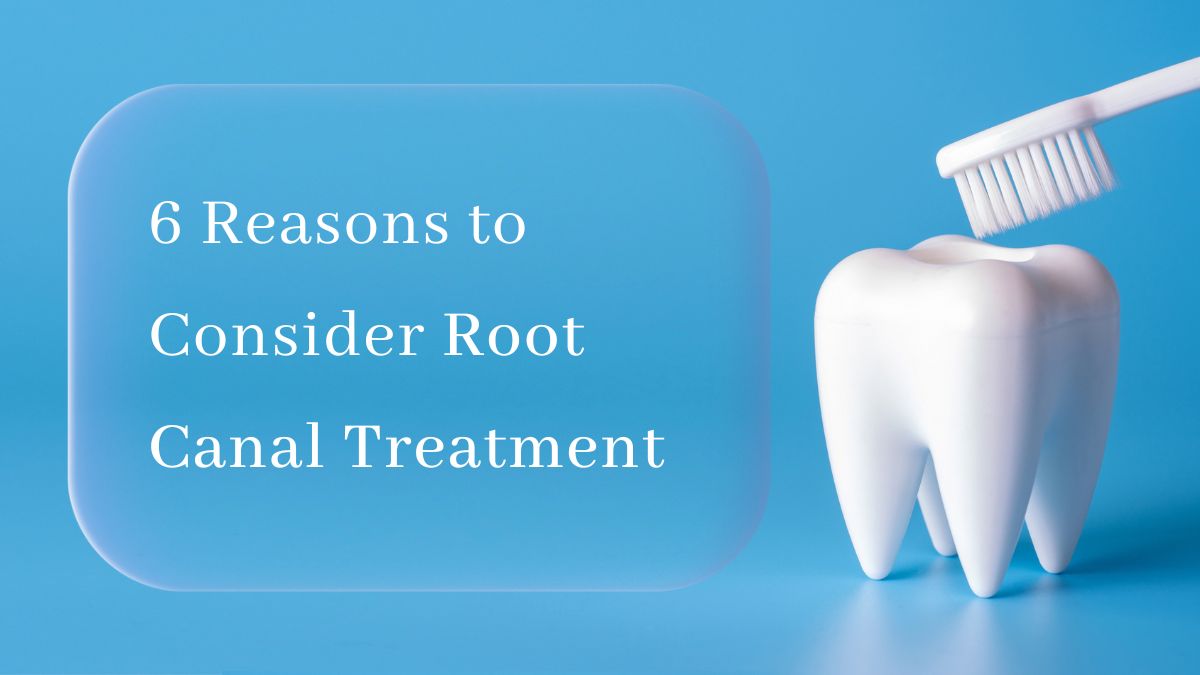 6 Reasons to Consider Root Canal Treatment 
