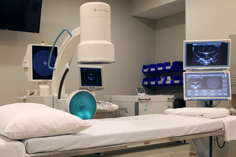Minimally Invasive Stone Treatment: Exploring the Potential of Extracorporeal Shock Wave Lithotripsy