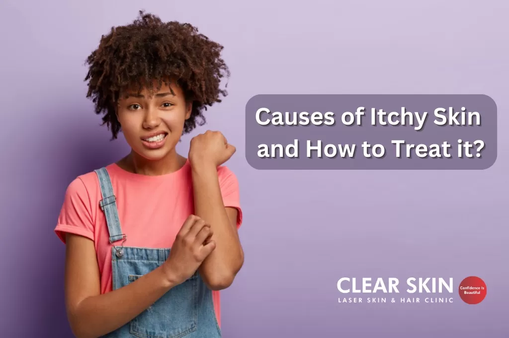 Causes of Itchy Skin and How to Treat it?